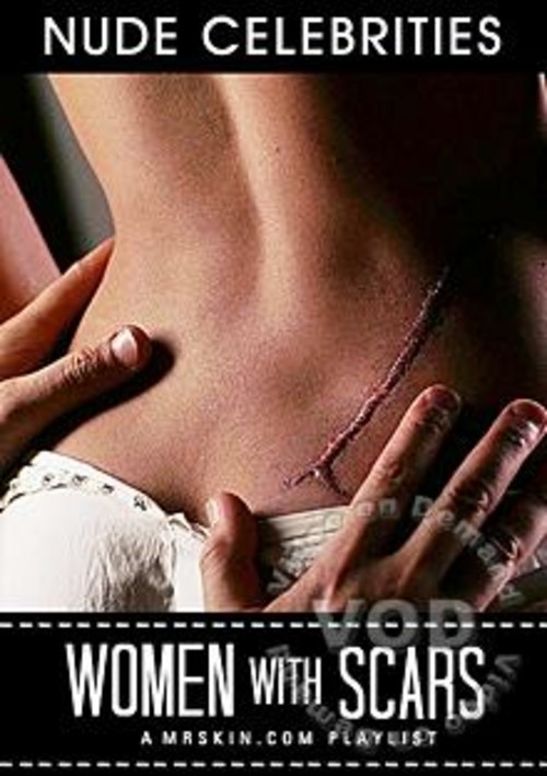 Women With Scars