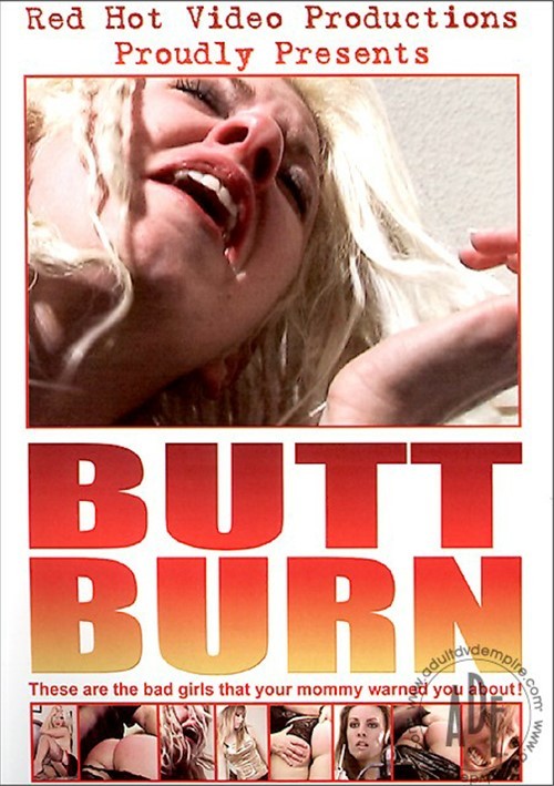 Butt Burn